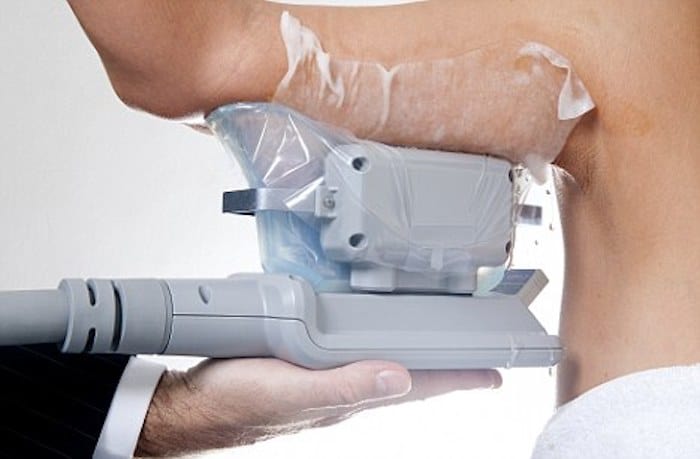 fat freezing arms Harlow
