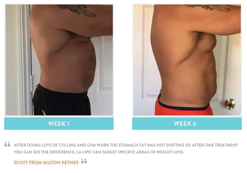 Before & After Stomach Fat Harlow