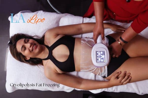 woman getting cryolipolysis Harlow