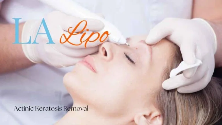 Woman receiving Actinic Keratosis Removal Treatment Harlow