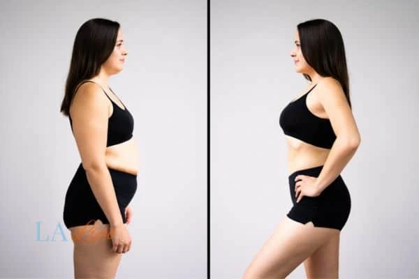LA-EMS Body Sculpting Harlow results before and after of womans results on body toning.