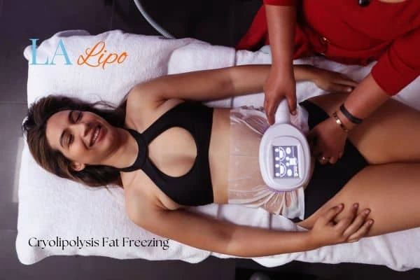 woman getting cryolipolysis Harlow