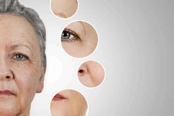 HIFU Facelift Harlow from LA LIPO