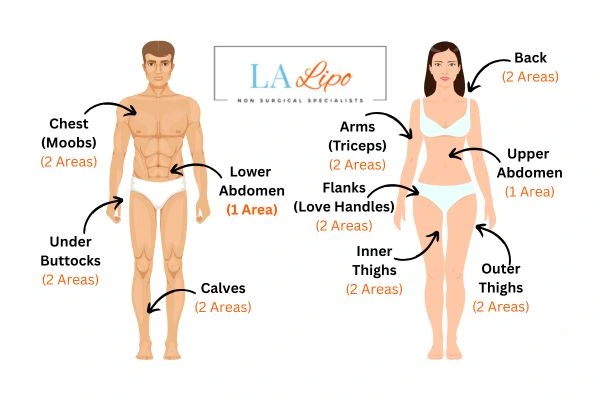 LA LIPO Cryolipolysis Areas Harlow