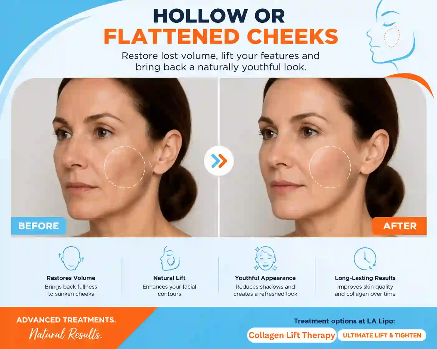 Sign #4: Hollow or Flattened Cheeks Harlow