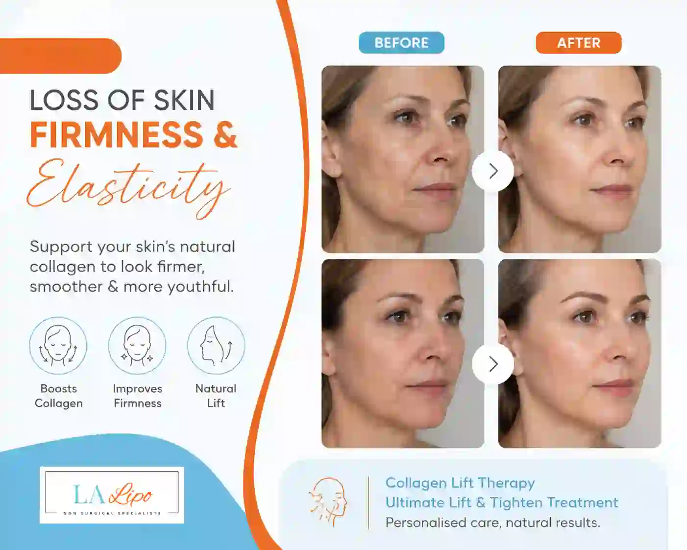 Sign #7: Loss of Skin Firmness and Elasticity Harlow
